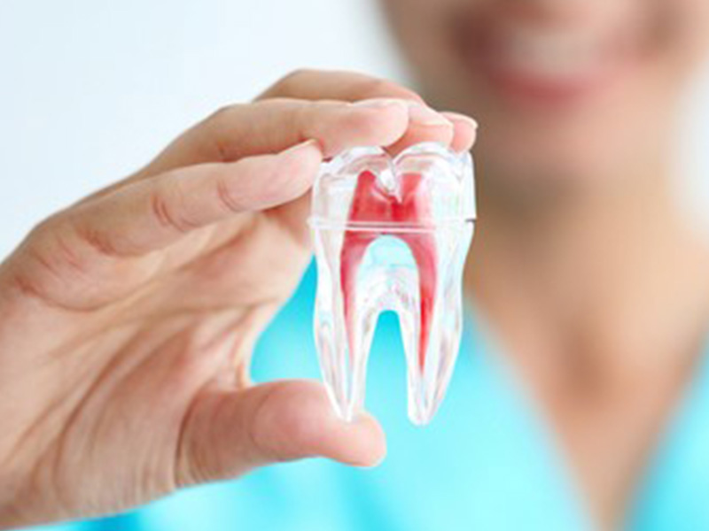 歯を残すための治療「根管治療」とは